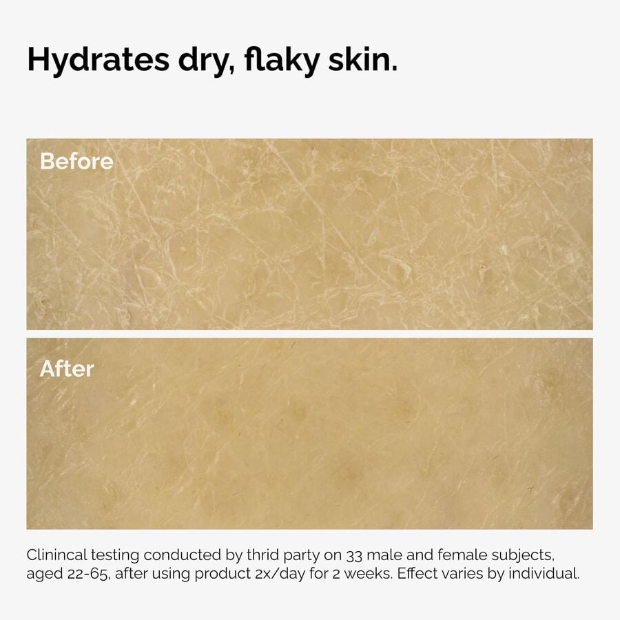 the-body-care-collection-l5 ord-natural-moisturizing-factors-inulin-body-before-after-graphic-02.jpg