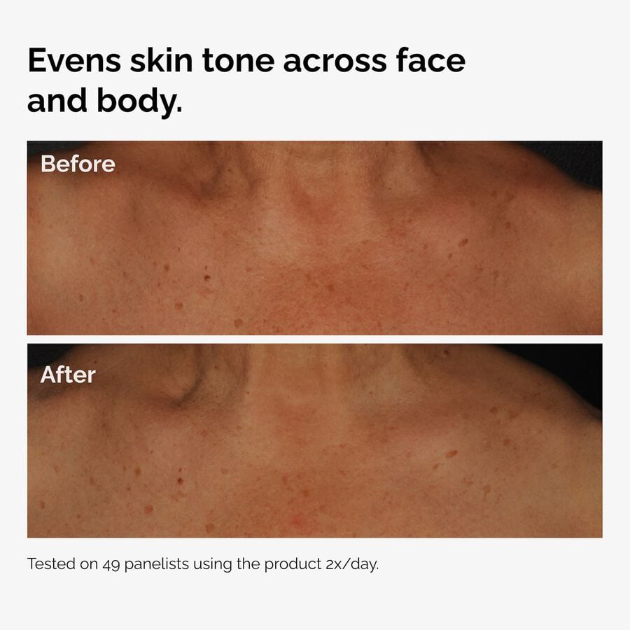 the-body-care-collection-l5 ord-niacinamide-face-body-serum-before-after-even-tone-graphic.jpg