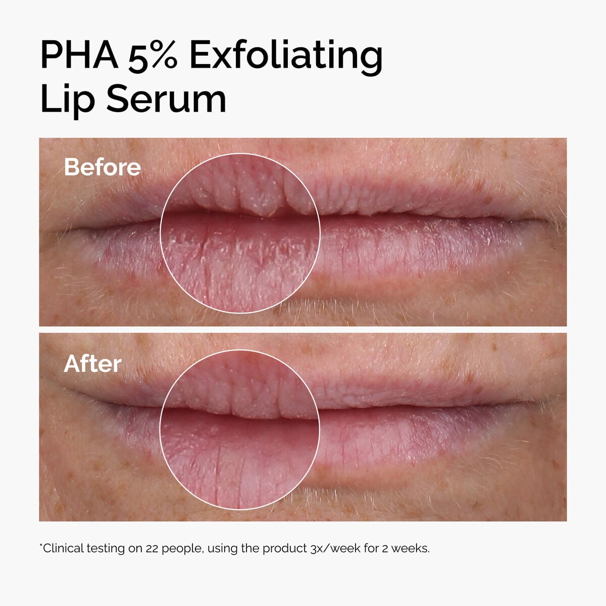pha-5-exfoliating-lip-serum-n4 ord-pha-5pct-lip-exfoliating-serum-before-after.jpg