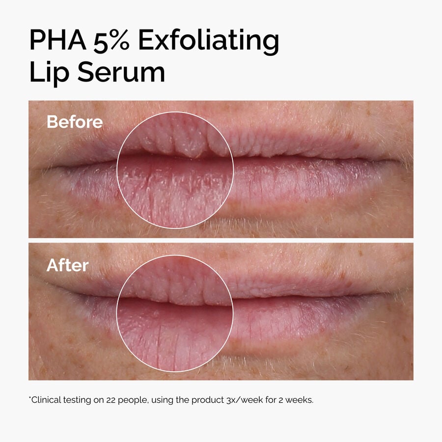 pha-5-exfoliating-lip-serum-n4 ord-pha-5pct-lip-exfoliating-serum-before-after.jpg